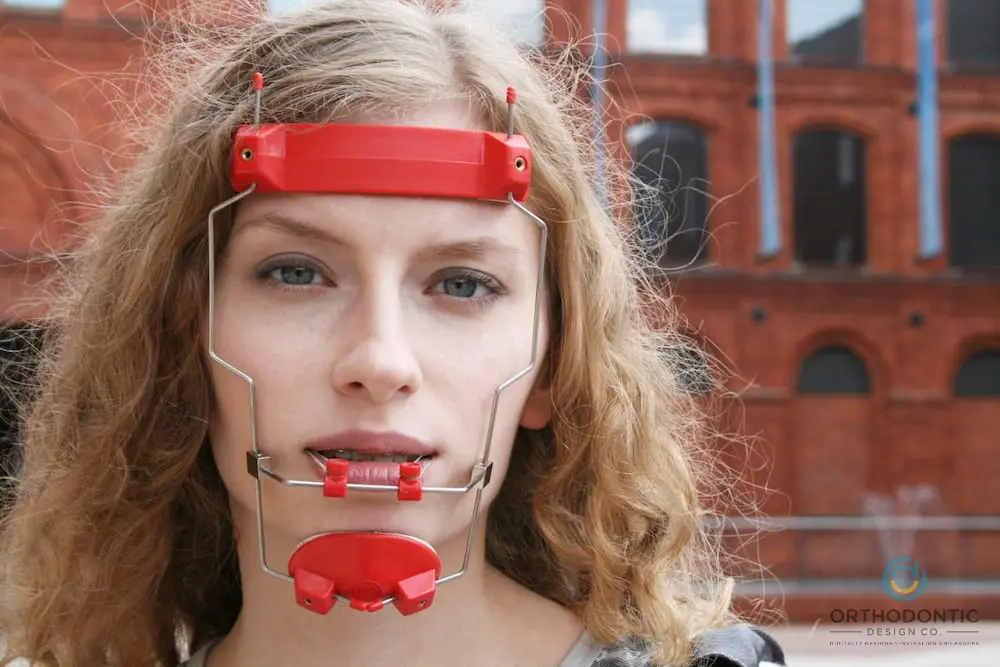 Person wearing a red and silver reverse pull headgear braces in Madison, AL with a brick building in the background.