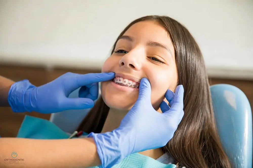 At Orthodontic Design Co. Orthodontics, a dentist in blue gloves examines a smiling young girl’s braces and discusses how to fix overbite in Madison and Huntsville, AL.