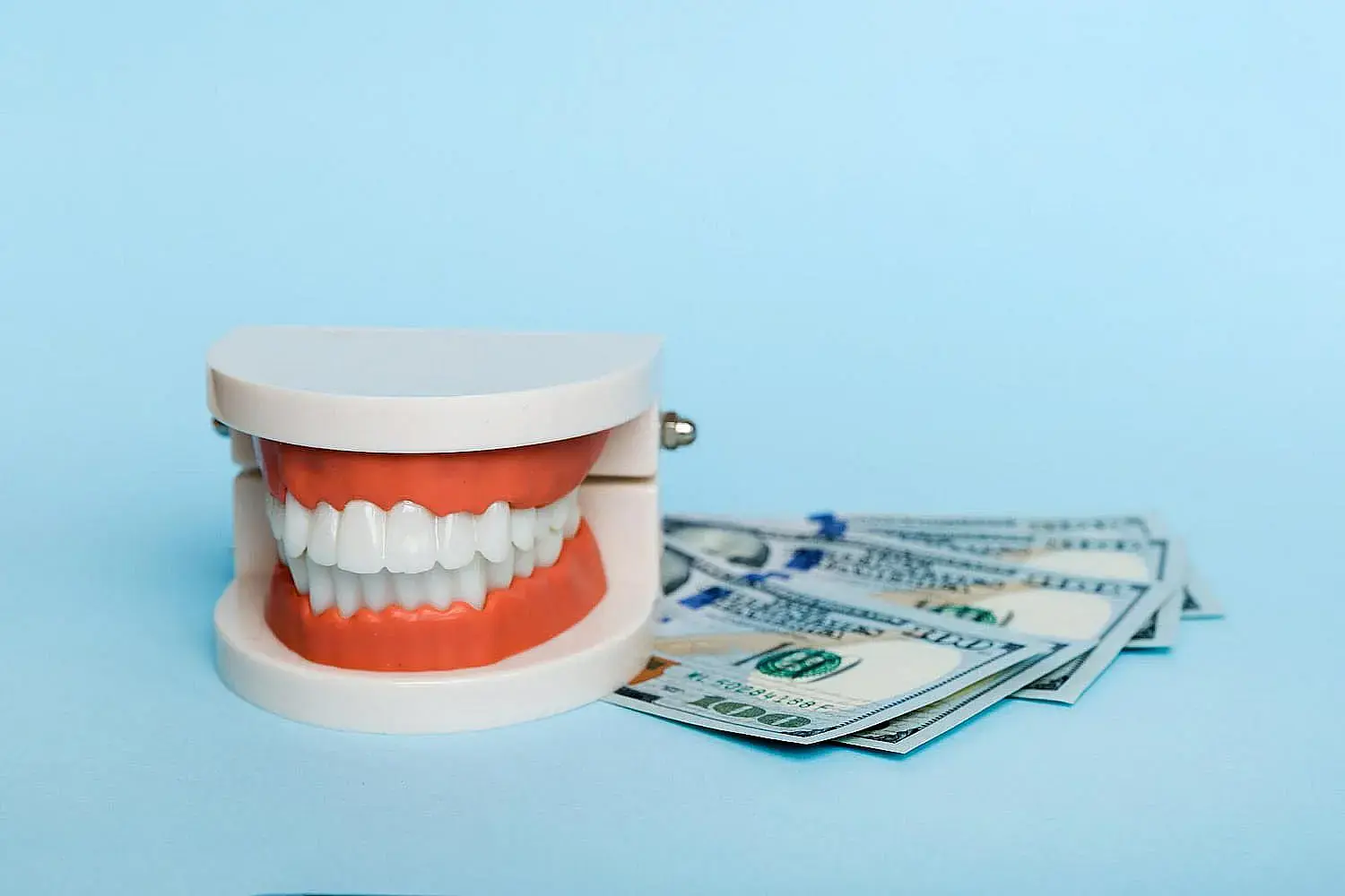 A dental model and hundred dollar bills sit on a light blue background show Invisalign payment at Orthodontic Design Co. Orthodontics in Madison and Huntsville, AL. A dental model and hundred dollar bills sit on a light blue background show Invisalign payment at Orthodontic Design Co. Orthodontics in Madison and Huntsville, AL.